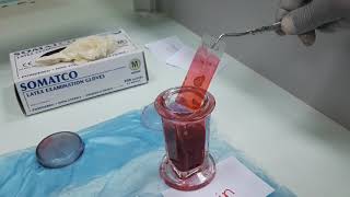 How to do H&E staining/طريقة الهيماتوكسيلين واليوزين لشرائح الأنسجة باختصار للطلاب