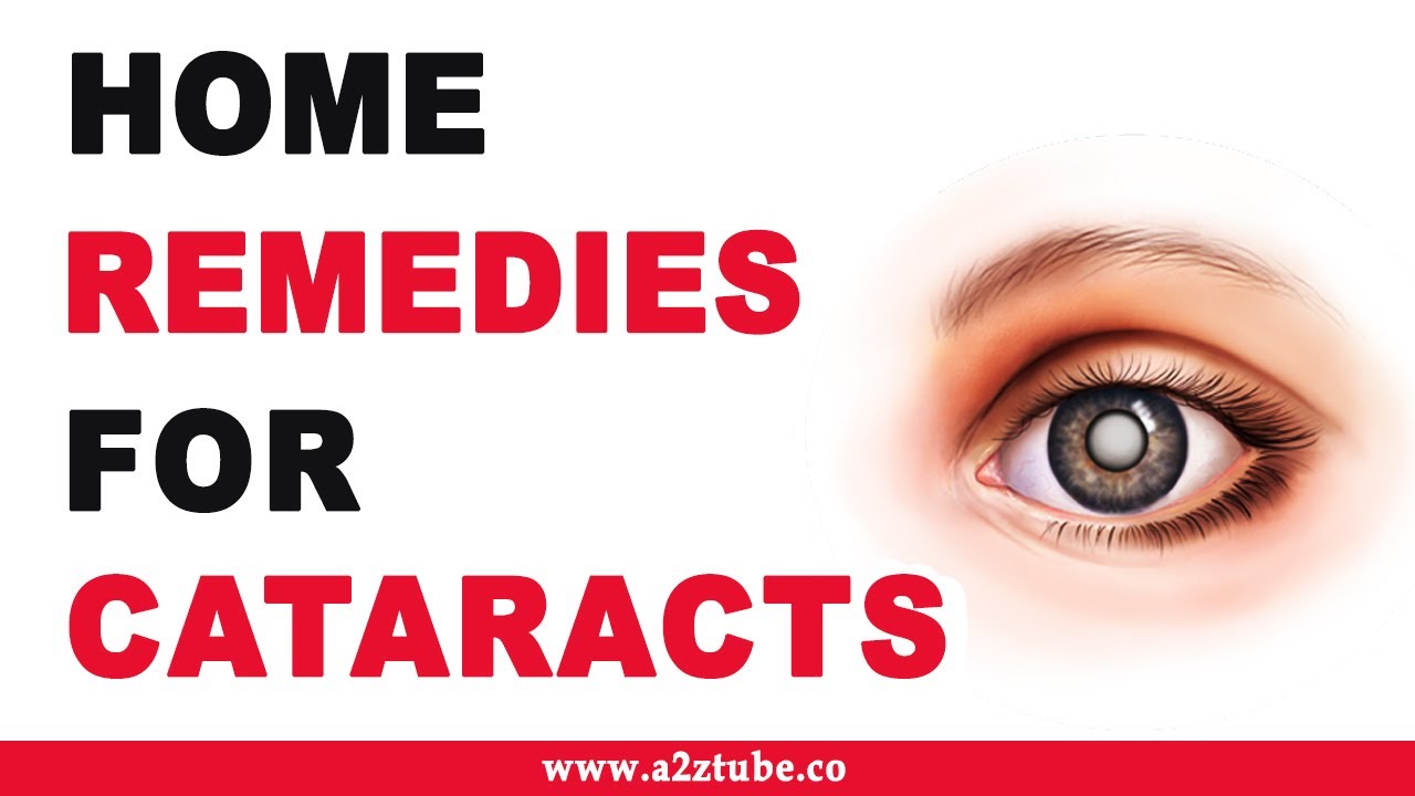 Home Remedies for Cataracts Natural and Ayurvedic YouTube