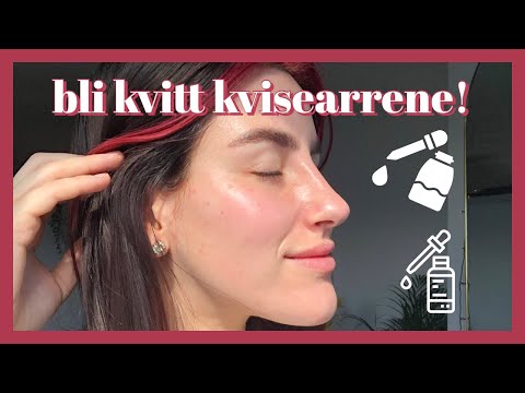 Video: 4 måter å bli kvitt solflekker