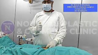 Zsr Circumcision Surgery Jaipur Kolkata Ahmedabad Pune Hyderabad Bangalore Gwalior