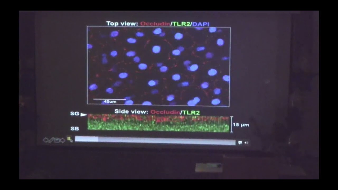 MED Talks: From the study of eczema to vaccination delivery | Lisa Beck '87M (Res)