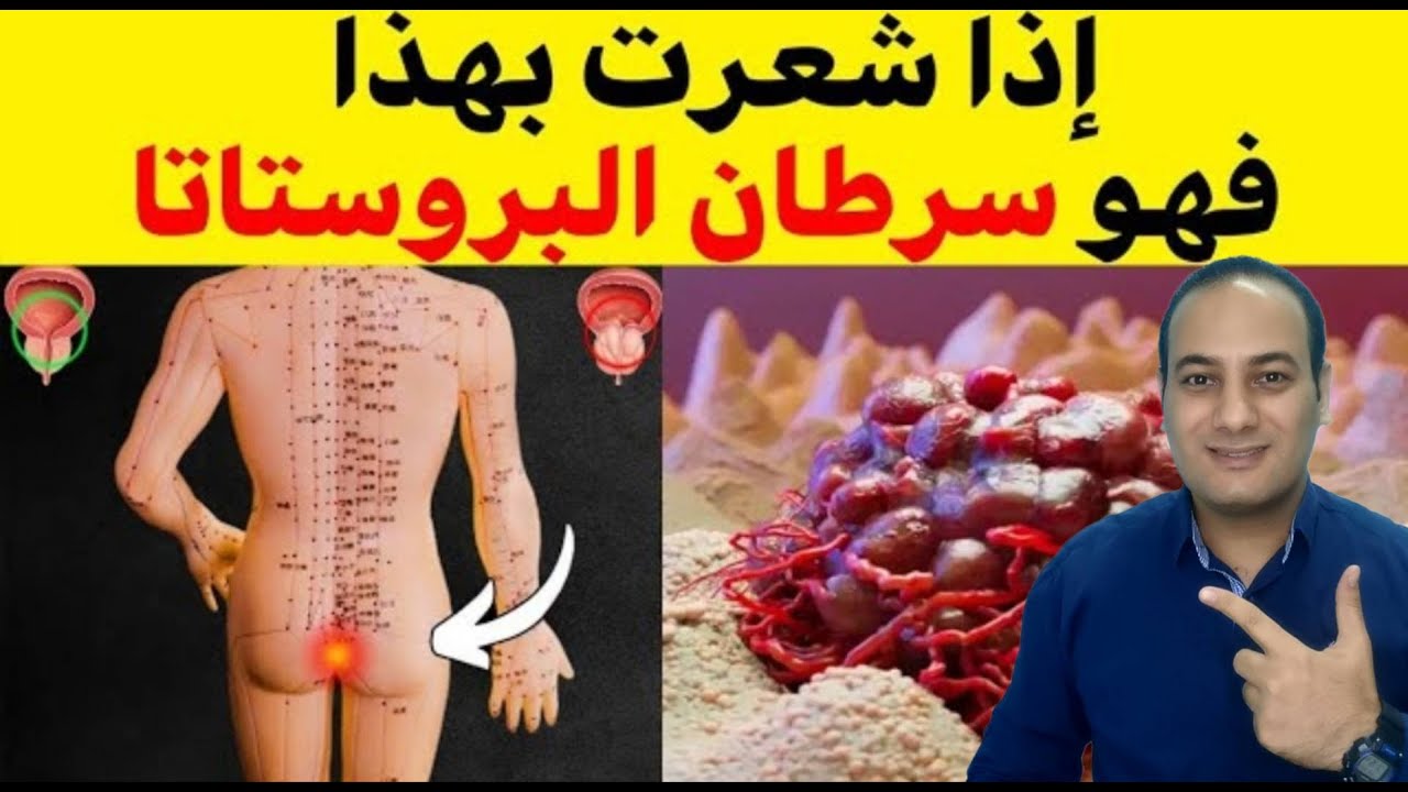 8 علامات مؤكده للسرطان في جسمك وانت لا تعلم/ما هي اعراض سرطان البروستاتا المبكرة!