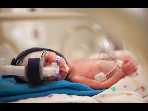 生きて わずか500gで誕生 必死に生きる赤ちゃんに奇跡が起きる Youtube