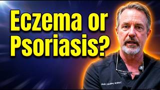 Psoriasis Treatments That Actually Work in 2026
