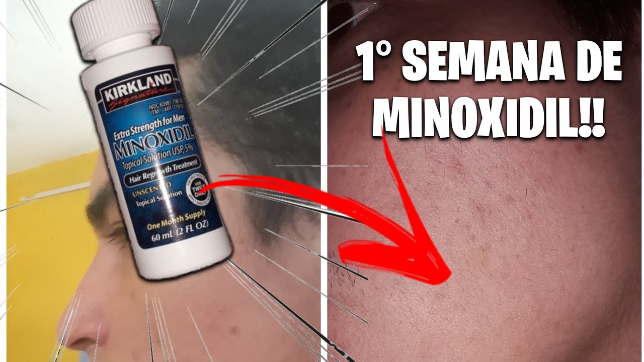 Quanto Tempo Leva Para Benzetacil Fazer Efeito
