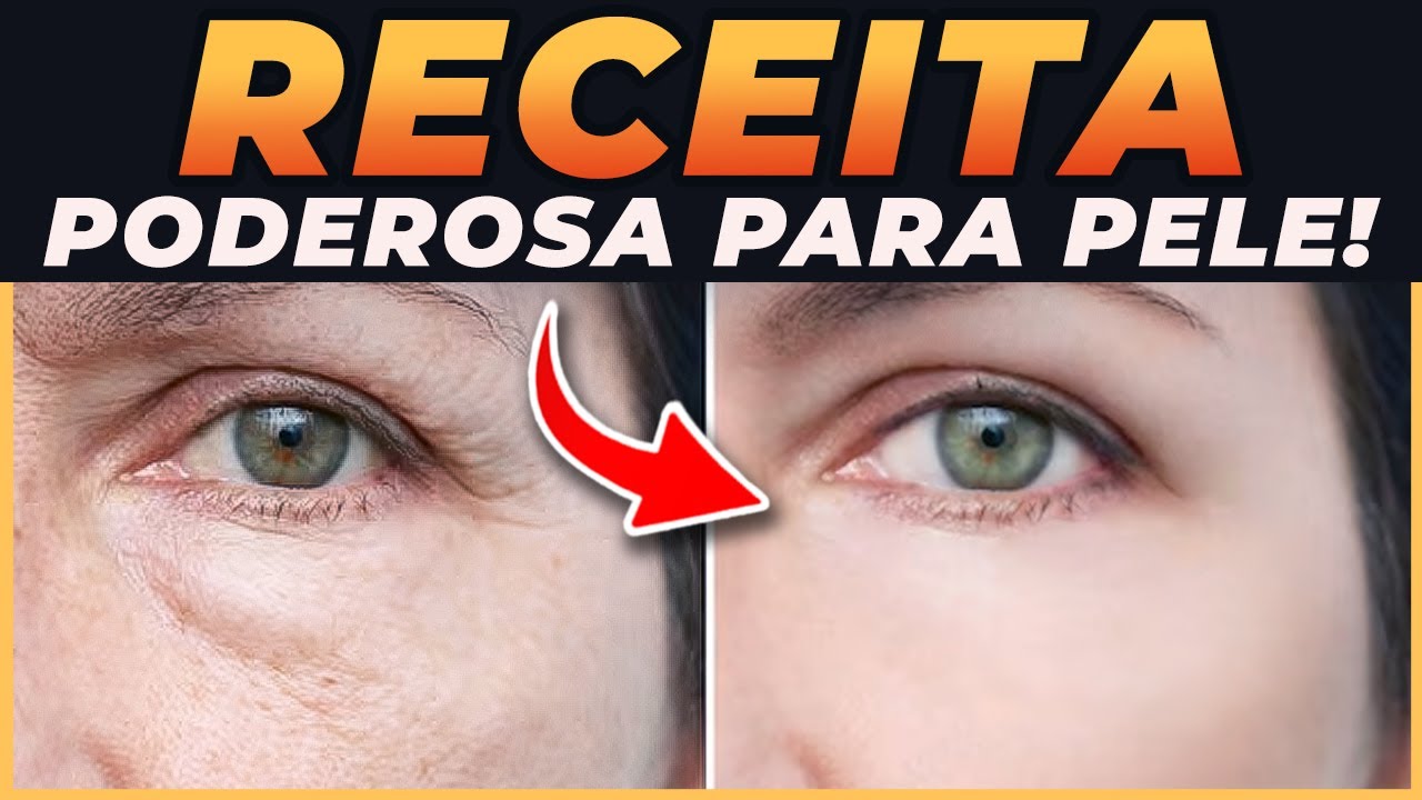 EU Vou te ENSINAR Como ESTICAR RÁPIDO A PELE - YouTube