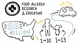 Food Allergy Awareness Training for Food Handlers | Whiteboard Safety Video