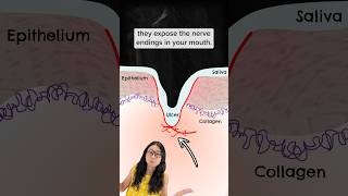 How do ulcers form