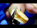 Wow, Such Long Toenails, Carefully Trimmed~【Xue Yidao】