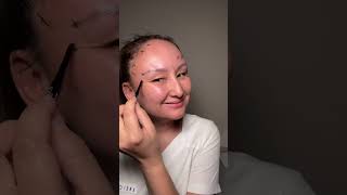#ботокс #диспорт #botox #фейсбилдинг #морщины #косметолог #лифтинг #beauty #skincare #межбровка