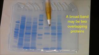 Beta Lactamase Purification Ysis With Sds Page