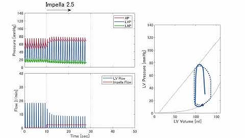 PV loop －escalation of Impella－