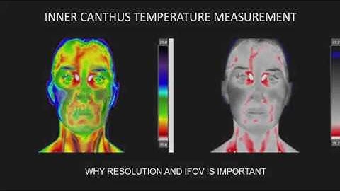 Fever detection using thermal camera - how specification influence accuracy