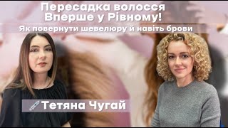 Пересадка волосся - вперше у Рівному. Можна повернути навіть брови | Інтерв'ю Тетяна Чугай