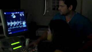 Echocardiography_video4.avi