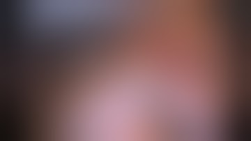 Korea: Key point for Laparoscoic Assisted Pylorus Preserving Gastrectomy