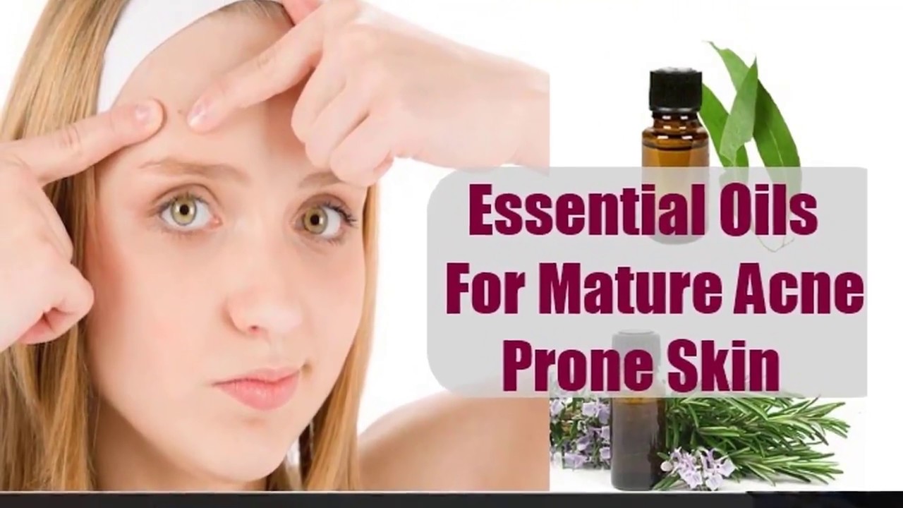 Herbal Remedies Acne and Facial Blemishes Natural Remedies Top 4