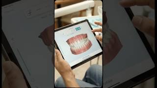 Metal Braces vs Invisalign! 💥 எது Best? 2026 Price & Reality Check!#invisalign #braces
