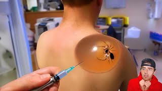 he shouldn't have popped it..