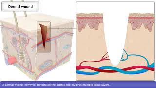 Skin Wound Healing Process