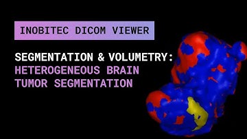 Segmentation and volumetry: heterogeneous brain tumor segmentation
