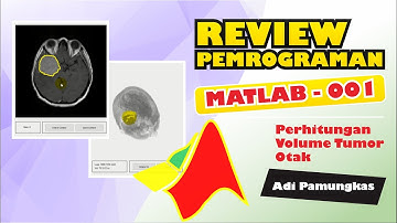 Review Pemrograman MATLAB - 001 - Perhitungan Volume Tumor Otak Pada Modalitas MRI
