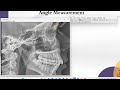 Image J: Angle Measurement