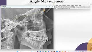 Image J: Angle Measurement