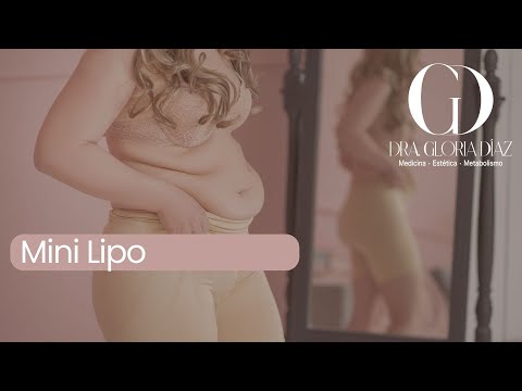Minilipo: una guía rápida si estás pensando en hacerla