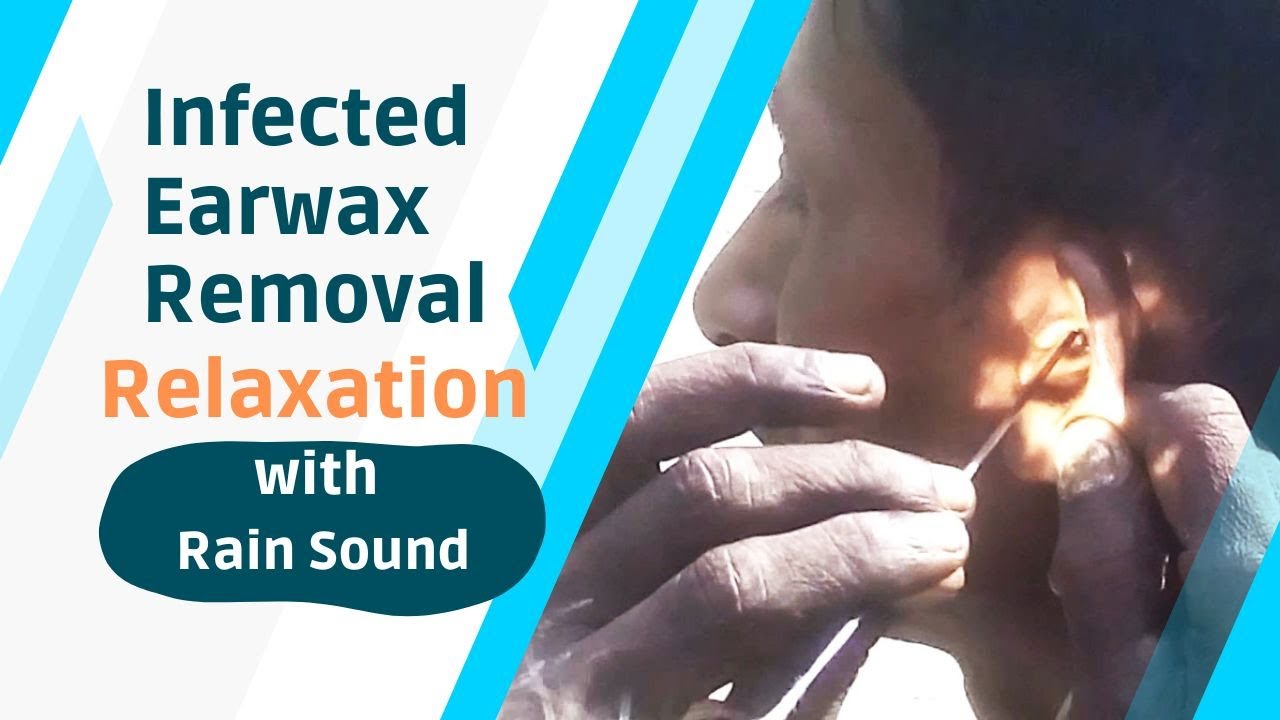 Fungal Infected Earwax Removal / Best Street Ear Cleaning / Rain Sound