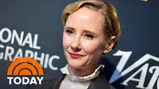 Anne Heche’s Death Ruled An Accident By Medical Examiner