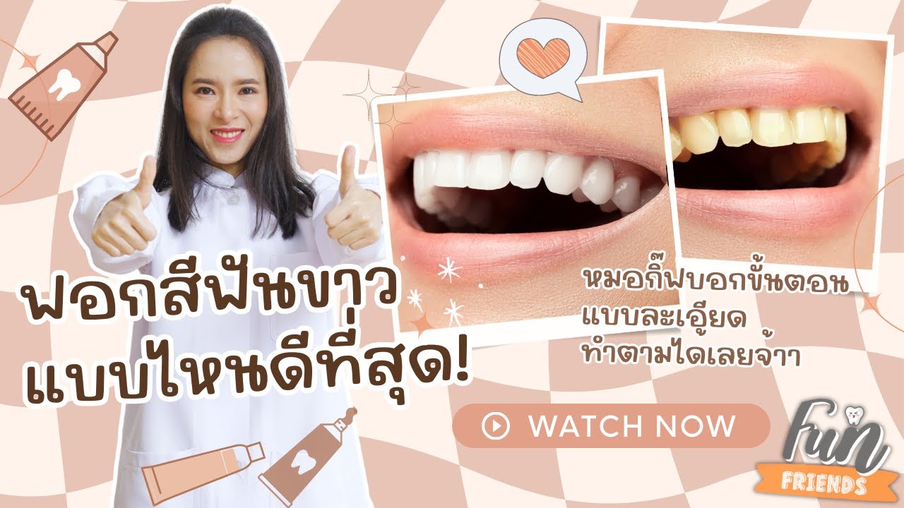 ฟอกสีฟันแบบไหน ได้ผลดีที่สุด! หมอกิ๊ฟบอกขั้นตอนแบบละเอียด ทำตามได้เลยจ้า |FunFriends เพื่อนกันฟันดี|