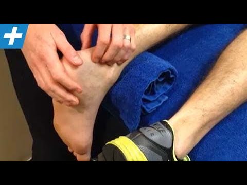 Achilles tendon rupture - week 6 post-op surgical repair | Feat. Tim Keeley | No.56 | Physio REHAB