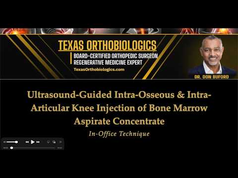 In-Office Stem Cell (BMAC) Knee Injection —Ultrasound-Guided Intra-Osseous + Intra-Articular (Steps)