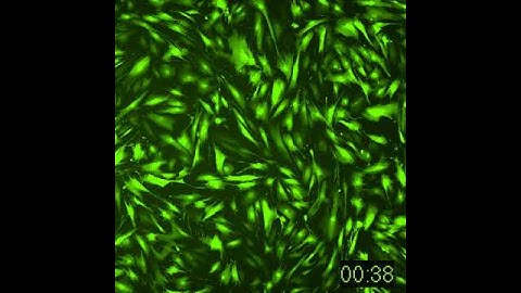Calcium Release Assay on ImageXpress Micro System