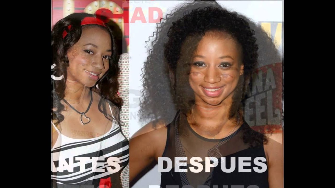 Personajes de disney channel antes y despues de adelgazar