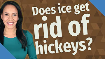 ¿El hielo elimina más rápido los chupetones?