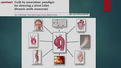 Quando operare arteria aorta ascendente?