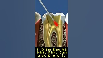 7 Lời Dặn Sau Khi Điều Trị Tủy Răng  I Bác sĩ Nguyễn Đình Dương