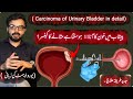 Do you have these symptoms❓️|CA Urinary Bladder|Urologist|Dr Ghazanfar #urinarybladder #carcinoma 