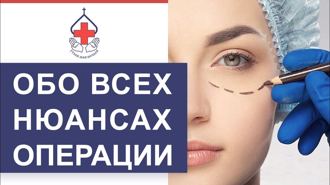 👀 Пластический хирург даст ответы на частые вопросы о блефаропластике. Блефаропластика вопросы. 12+