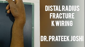 Distal Radius K wiring Surgery | Dr. Prateek Joshi #ortho #kwire #fracture