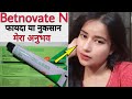 Betnovate N Cream | Honest Review | Uses & Side Effects|complete  information in Hindi