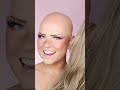 Bald to blonde… *The RESULTS video