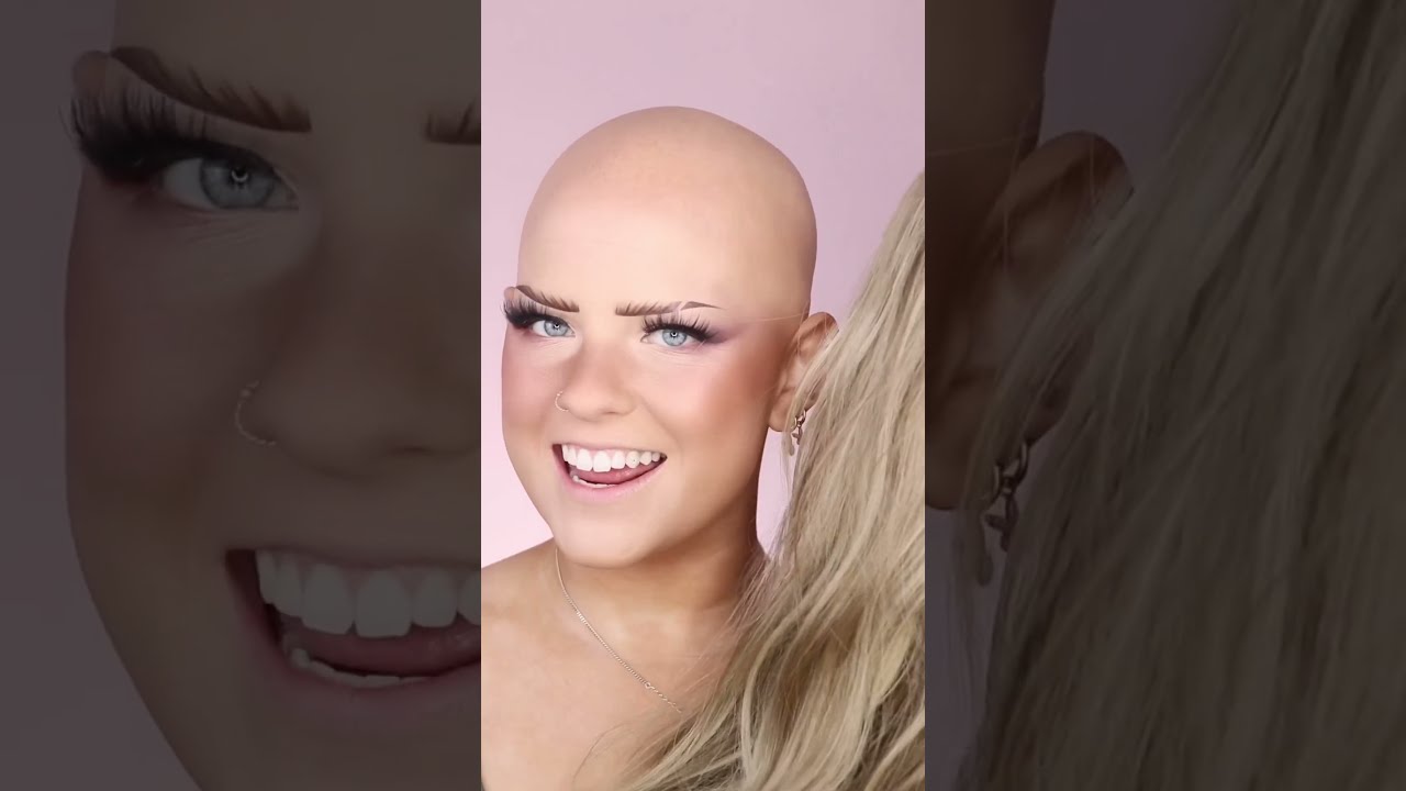 Bald To Blonde The RESULTS Video
