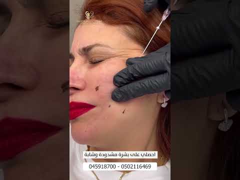 شد الوجه بالخيوط للحصول على مظهر أكثر ثقة وشبابا   تجميل دبي  دبي