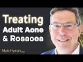 Treating Adult Acne & Rosacea From The Inside Out