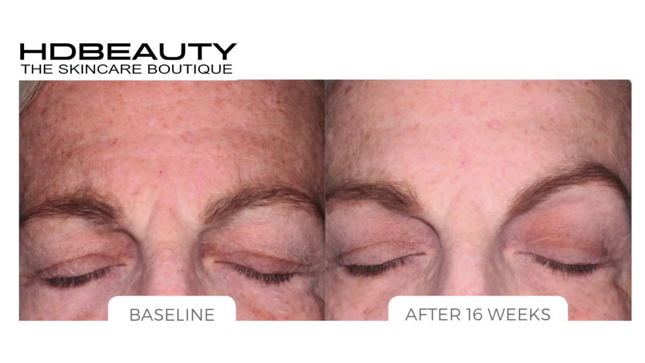 Skin Type 3 HD Beauty Skincare System