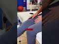 Before You Ignore Your Hip Pain… Watch This