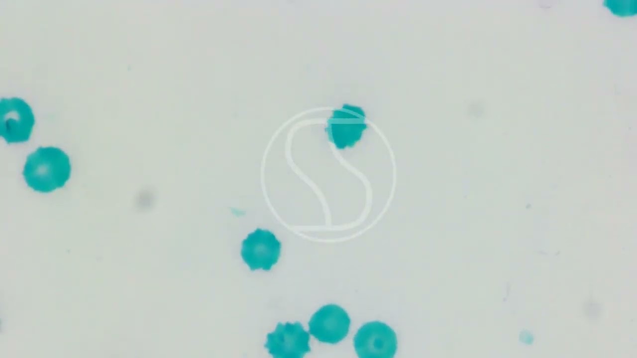 Red Blood Cells with McManus’ PAS Stain